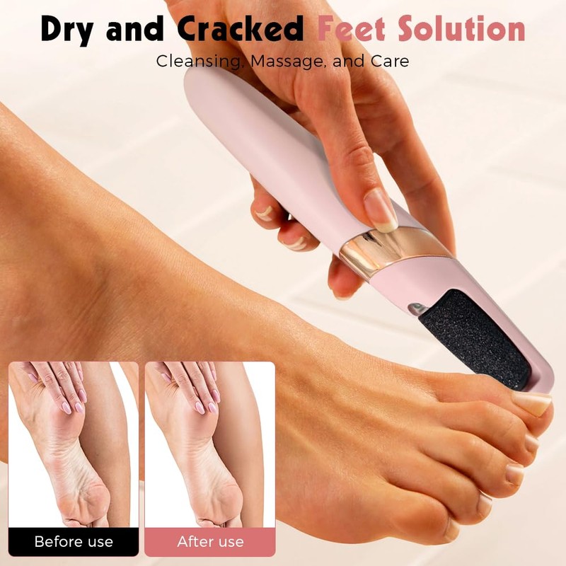 Electric Foot File - Foot Scrubber for Feet, Professional Pedicure
