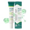 Suero De Ácido Azelaico, Gel Para Tratamiento Del Acné, Ácid