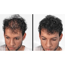 Maxx Pro Series Volumising Hair Fibres with Real Keratin for Thin Hair / Hair Loss - Tested by Dermatologist - Hypoallergenic - 60 Days + Supply - Immediate Maximum Results - (Black)