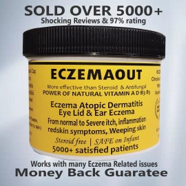 Intense Treatment for Eczema Rosacea cream Eczemaout Acne 4oz