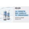 Nioxin Champú Anticaida - Champú para la Caída del Cabello