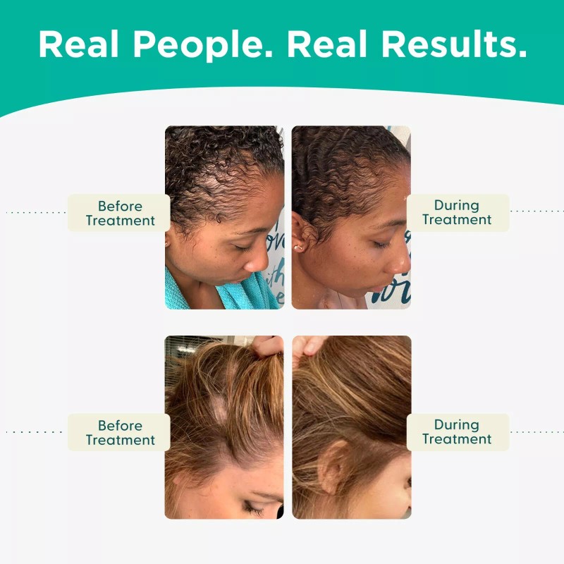 Shapiro MD Hair Loss Shampoo and Conditioner, Vegan Formula with