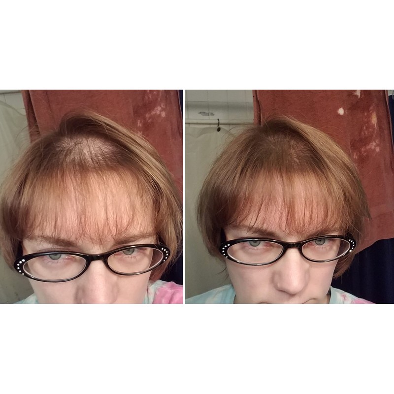 Caboki Value Pack 4, 360-Day Supply (Light Brown)