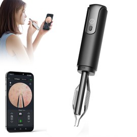 Pinza de eliminación de puntos negros con cámara de 1080p, máxima precisión: pinzas con cámara, perfecta para tareas delicadas. - Pinzas encarnadas para el pelo de las orejas (negro)