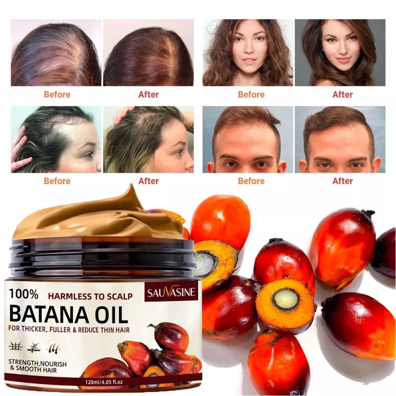 Natural BATANA OIL Hair Growth Serum- Fast Hair Regrowth Hair
