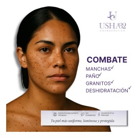 Kit Anti-manchas Mujeres Usha32: Limpieza, Sérum Y Protector
