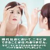Cata-MEDICA ニキビパッチ 薄型 簡単 貼るだけ ハイドロコロイド 簡単 貼るだけ ニキビケア アクネパッチ