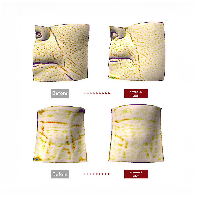 Centellian24 [Centellian24]Madeca Cream Time Value Set (50mlX2ea + 15mlX3ea)