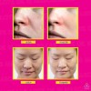 10 Mascarillas Faciales Hidratantes Extractos Frutales Tipo de piel Paquete