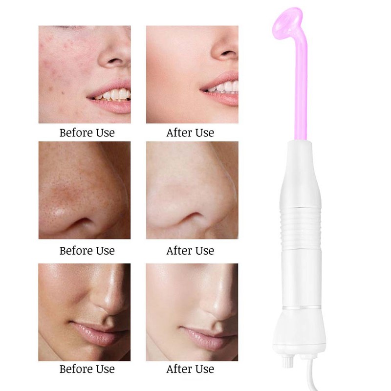 High Frequency Electrotherapy Purple Light Skin Tightening Beauty Machine Facial