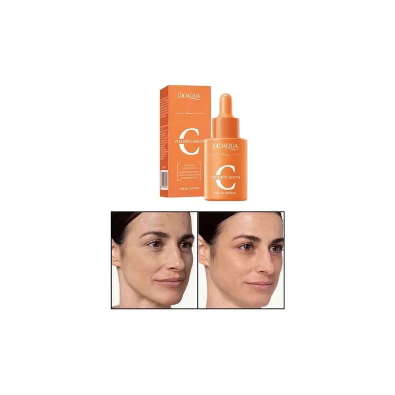 Crema Serum Despigmentante Vitamina C Paño Manchas Aclara Todo Tipo