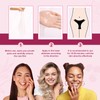 5pcs Women Private Part Mask Dilute Melanin Deep Moisturizing Skin