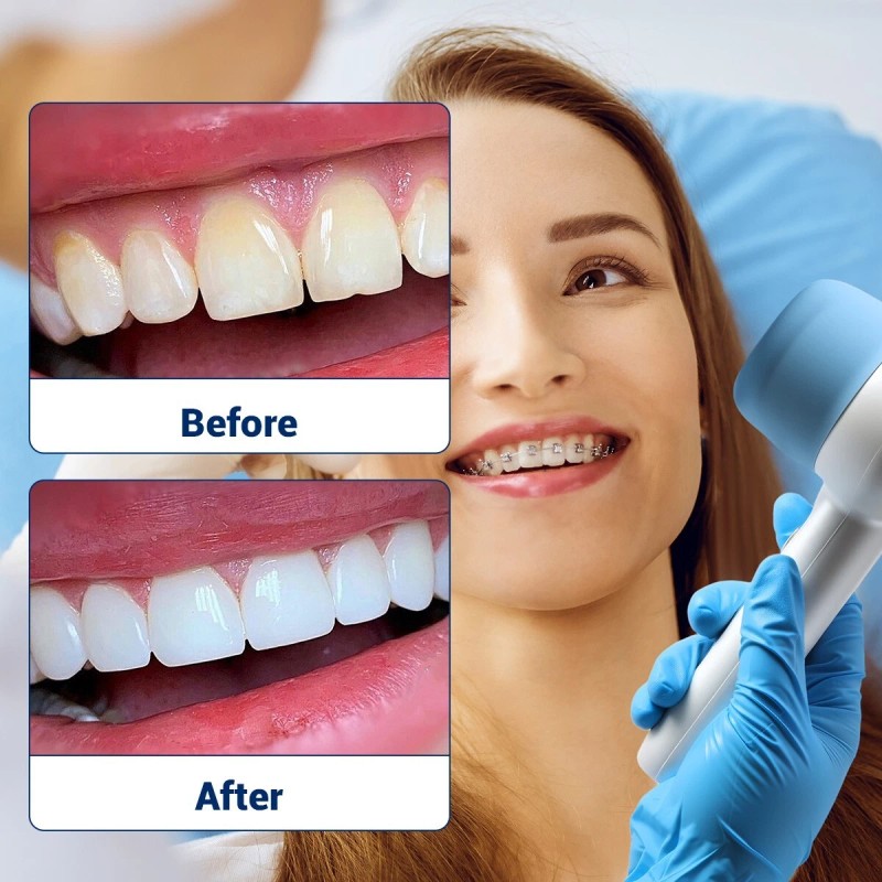 AZDENT Dental LED Cold Light 4 Color Desk Tooth Whitening