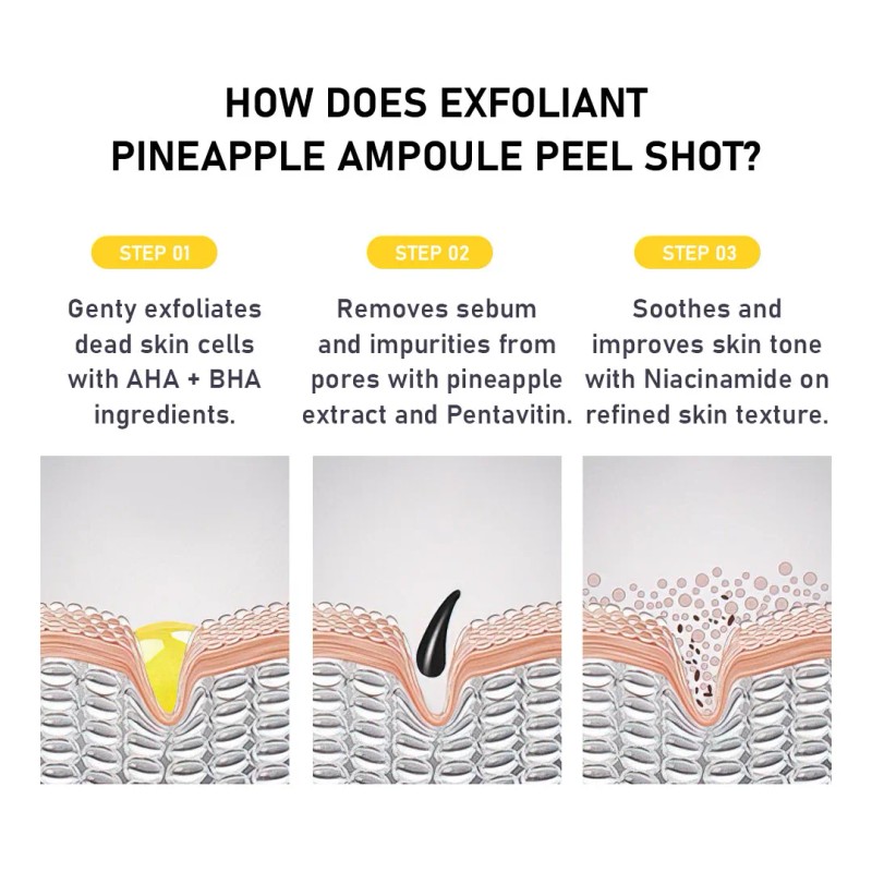 Phofay Sérum Exfoliación Niacinamida Ácido Tendencia Acnéica