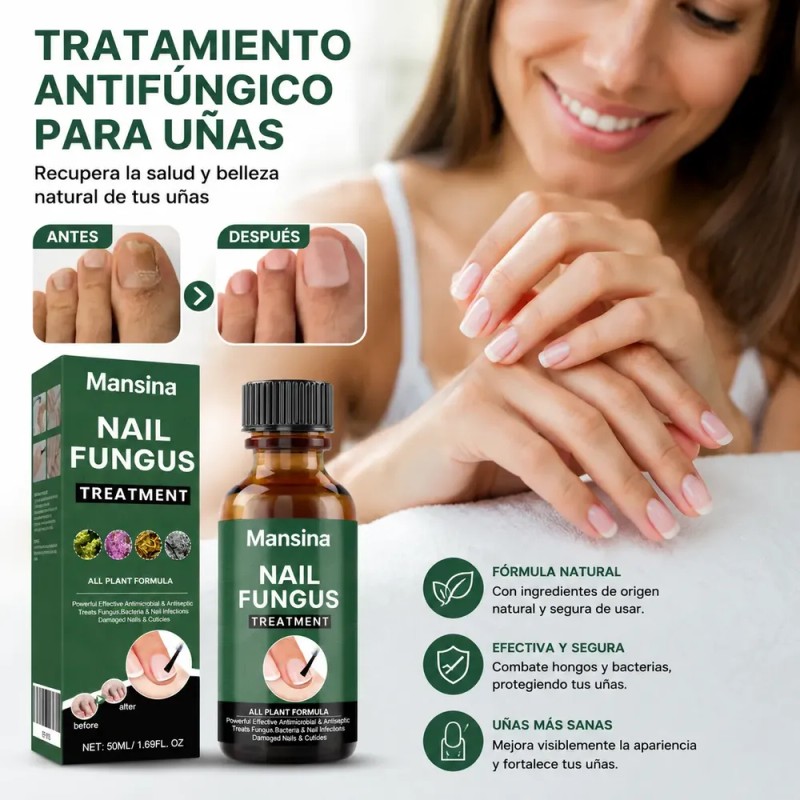 Eelho Líquido Para Hongos En Uñas Cura Hongos Y Onicomicosis