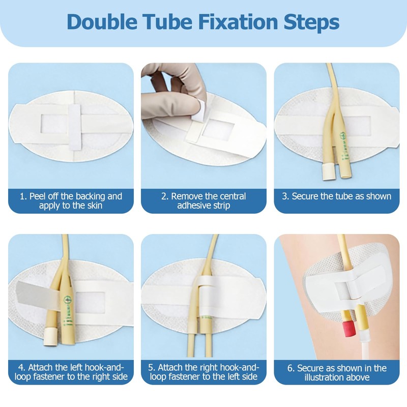 12 Pack Foley Catheter Stabilization Device, Self Adhesive Catheter Tube