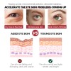 Srum Anticrculo Con Retinol Para Ojeras, Ojeras Y Ojeras