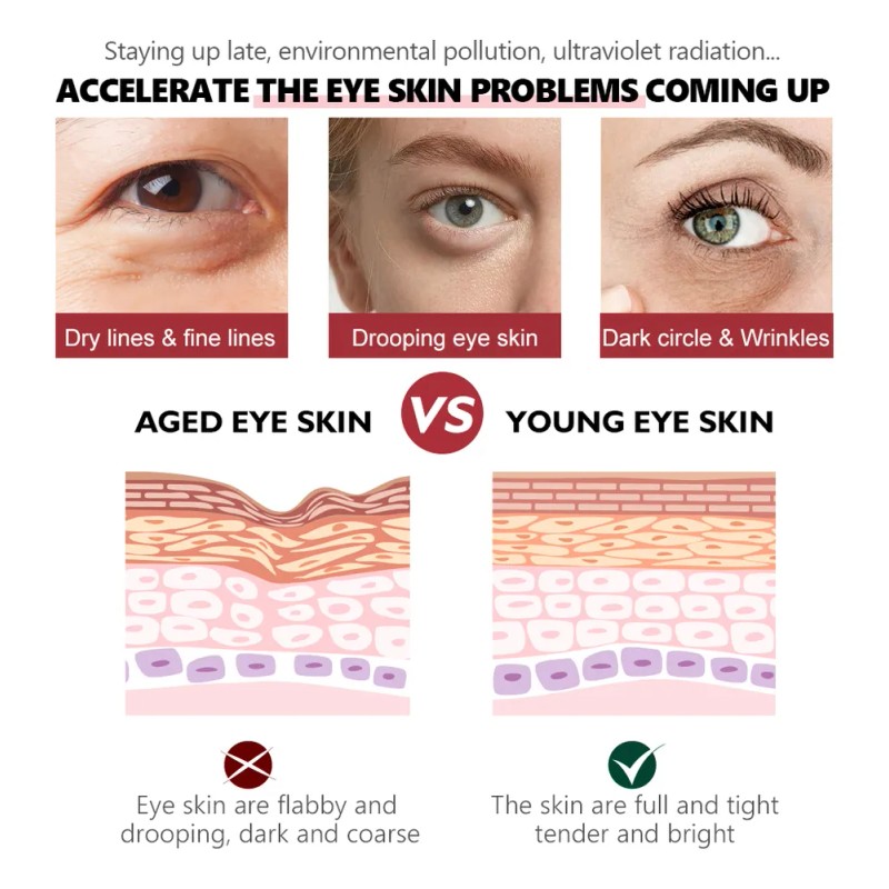 Srum Anticrculo Con Retinol Para Ojeras, Ojeras Y Ojeras