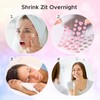 LitBear Acne Pimple Patch, 360 Dots 3 Shaped Colors Pimple