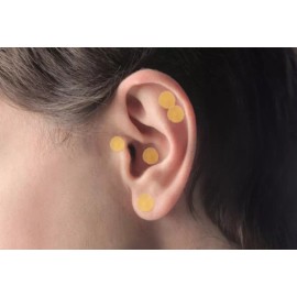 Acupuntura Bioenergética 3 Millares De Baline Magnetizados Para Auriculoterapia Mixto