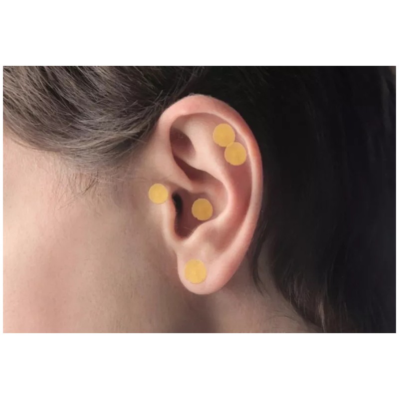 Acupuntura Bioenergética 3 Millares De Baline Magnetizados Para Auriculoterapia Mixto
