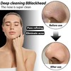 2 Stück Blackhead Remover,30 ML Mitesserentferner Stripes,Blackhead Remover Strips,Gesicht und