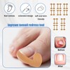 17pcs Ingrown Toenail Corrector Set, Professional Ingrown Toenail Pedicure Tools