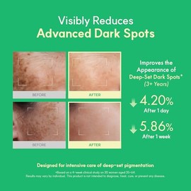 Easydew DW-EGF Melatoning Ampolla 5X - Suero Hidratante para Manchas Oscuras con Niacinamida y Glutatión para Piel Desigual - Ampolla de Absorción Ráp