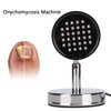Onychomycosis Treatment Light Toenail Fingernail Care Painless Onychomycosis Remover Device