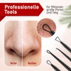 NEUMANN® Blackhead Remover Set (Stainless Steel) for Removing Pimples, Blackheads