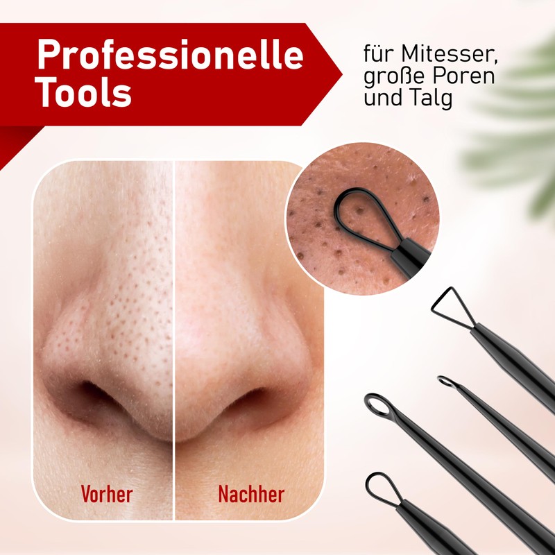 NEUMANN® Blackhead Remover Set (Stainless Steel) for Removing Pimples, Blackheads