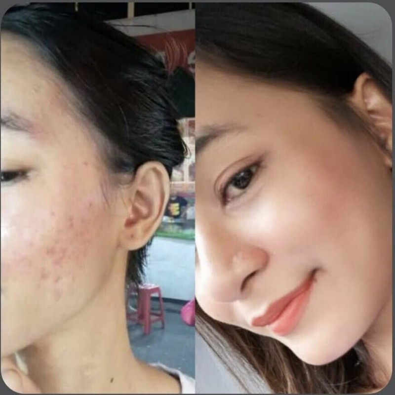 DIAMOND GLOW Collagen Skin Whitening Glowing Clear Acne Anti Aging