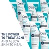 CeraVe Acne Foaming Cream Cleanser Acne Treatment Face Wash with