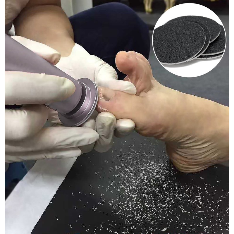 Electric Foot File for Dead Skin Removal with Replacement Pads