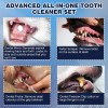 Raspador Dental Eléctrico Para Perros, Eliminador De Sarro