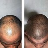Beard Growth Oil, Rapid Beard Thickening, Plant Based Beard Growth