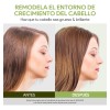 Kaisasa Aceite De Batana Shampoos Y Acondicionadores Kit