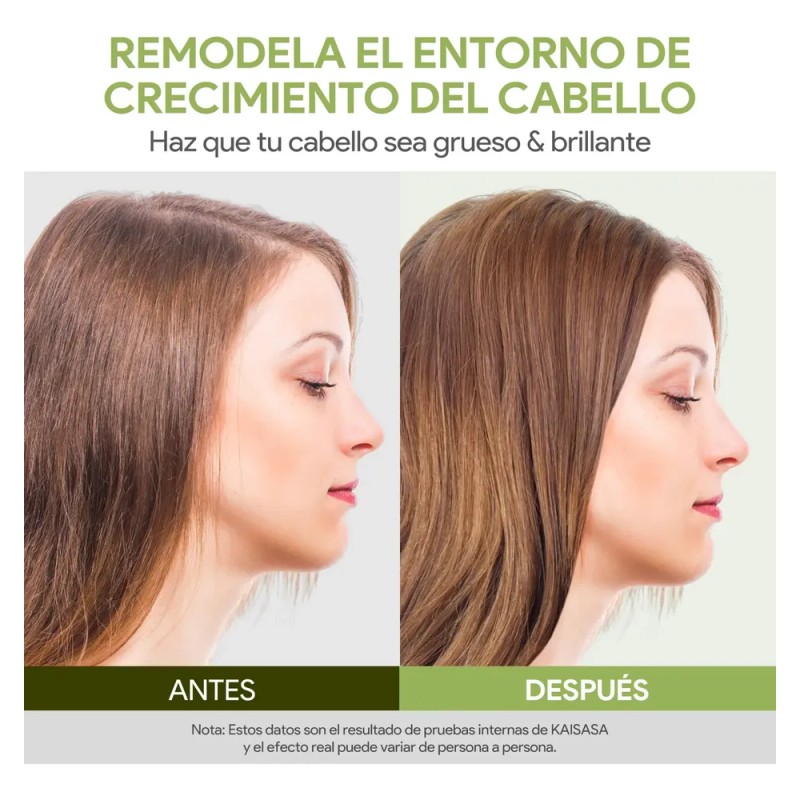 Kaisasa Aceite De Batana Shampoos Y Acondicionadores Kit