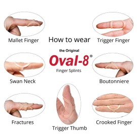 3-Point Products Oval-8 Finger Splint Size 14 (Pack of 1)