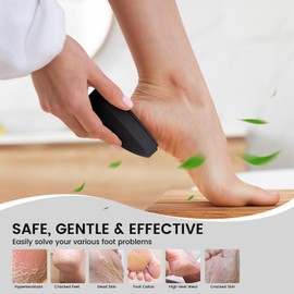 BEZOX Nano Glass Foot Pumice Stone Callus Remover with Cover – Gentle Glass Foot File Scraper, Effective Feet Scrubber for Dead Skin, and Portable Pedi Egg Foot Care Tool - Black