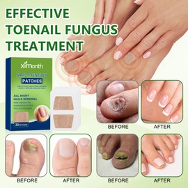 Pack of 96 Nail Fungus Plasters Nail Plasters Plasters Toenail Nail Repair Plasters Toenail Plasters Nail Fungus Plasters for Repair Discoloured and Damaged Nails Strengthening Nails