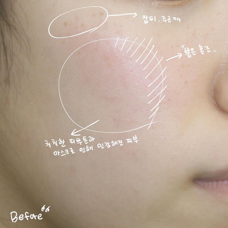 Retinaji Retinagy Skin Blemish Balm 30ml / 레티나지 스킨 블레미쉬밤
