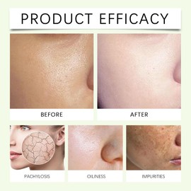 Gentle Facial Cleanser, 100 ml Cleansing Cream Daily Cleanser - Facial Cleansing Exfoliating Face Cleanser for All Skin Types, Cleansing Foam for Dry Skin - Oily or Acne Prone Skin