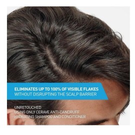 CeraVe Hydrating Anti Dandruff Shampoo, 1% Pyrithione Zinc Dandruff Treatment Wi