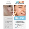 LitBear Large Pimple Patches, 168 Patches 5 Size, Acne Patches