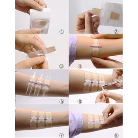 Laceration Wound Closure Device, Emergency Laceration Closure Strips to Repair - Single Unit
