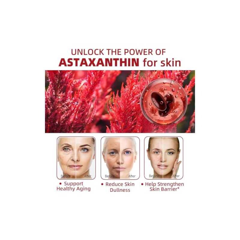 Astaxanthin 24mg with MCT Oil, Astaxanthin Antioxidant Supplements with Ashwagandha,