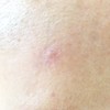 Spot for Night (Trouble soothing topical treatment) / 스팟 포