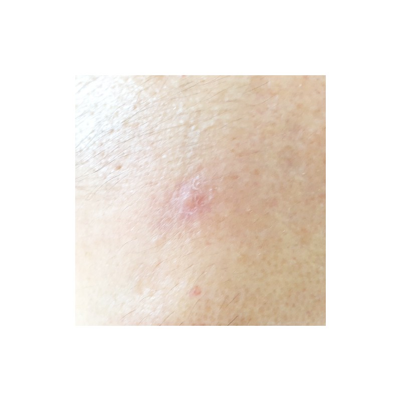 Spot for Night (Trouble soothing topical treatment) / 스팟 포