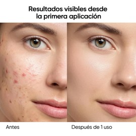 SKINTIFIC Mascarilla Facial en Barra de Mugwort para Limpieza Profunda, Stick de Arcilla Purificante con Mugwort para Puntos Negros, Skin Care Coreano para Control de Grasa y Piel Sensible, 40g